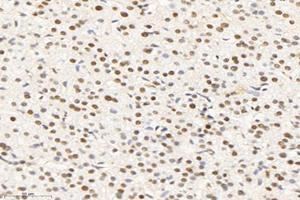 Immunohistochemistry analysis of paraffin-embedded human liver using,SET (ABIN7075583) at dilution of 1: 10000 (SET/TAF-I Antikörper)