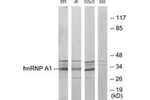 Western blot analysis of extracts from 293/Jurkat/COLO205 cells, using hnRNP A1 Antibody. (HNRNPA1 Antikörper  (AA 51-100))