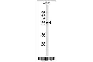 Western Blotting (WB) image for Mouse anti-Human IgD (AA 37-64) antibody (ABIN1498831) (Maus anti-Human IgD (AA 37-64) Antikörper)