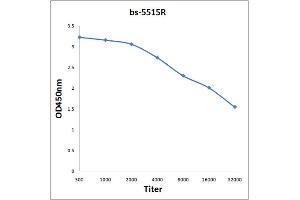 Antigen: 0. (NFKBIA Antikörper  (pTyr305))