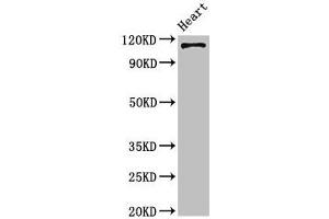 Western Blot Positive WB detected in: Mouse heart tissue All lanes: ITGA5 antibody at 4 μg/mL Secondary Goat polyclonal to rabbit IgG at 1/50000 dilution Predicted band size: 115 kDa Observed band size: 115 kDa (ITGA5 Antikörper  (AA 220-472))