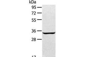 Western Blot analysis of A172 cell using STX2 Polyclonal Antibody at dilution of 1:400 (STX2 Antikörper)
