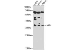 Western blot analysis of extracts of various cell lines, using  antibody (ABIN6129884, ABIN6137152, ABIN6137153 and ABIN6214229) at 1:1000 dilution. (ART1 Antikörper  (AA 23-295))