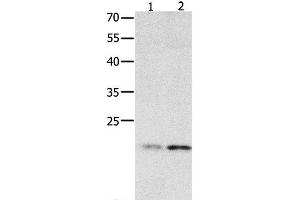 Western Blot analysis of 231 cell and Human fetal liver tissue using HMGB4 Polyclonal Antibody at dilution of 1:500 (HMGB4 Antikörper)