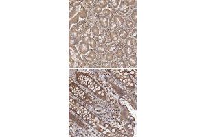Immunohistochemical staining of human rectum with ARHGEF10L polyclonal antibody  shows strong cytoplasmic positivity.