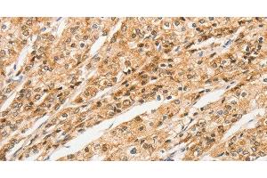 Immunohistochemistry (Paraffin-embedded Sections) (IHC (p)) image for anti-Signal Transducing Adaptor Molecule (SH3 Domain and ITAM Motif) 1 (STAM) antibody (ABIN7236033)