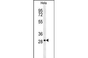 T Antibody (N-term) (ABIN651700 and ABIN2840367) western blot analysis in Hela cell line lysates (35 μg/lane). (TMEM165 Antikörper  (N-Term))