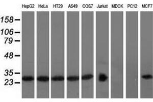 Western blot analysis of extracts (35 µg) from 9 different cell lines by using anti-RABL2A monoclonal antibody.