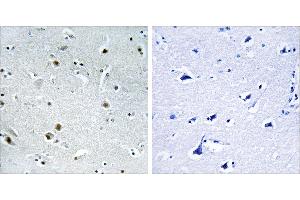 Peptide - +Immunohistochemistry analysis of paraffin-embedded human brain tissue using DDX24 antibody.