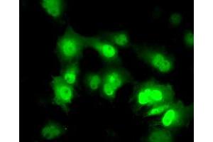 Anti-PPME1 mouse monoclonal antibody (ABIN2453495) immunofluorescent staining of COS7 cells transiently transfected by pCMV6-ENTRY PPME1 (RC200009). (PPME1 Antikörper)