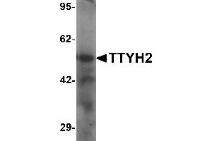 Western blot analysis of TTYH2 in human kidney tissue lysate with TTYH2 antibody at 1 µg/mL