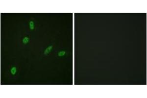 Immunofluorescence analysis of HeLa cells, using ETS1 (Ab-38) Antibody. (ETS1 Antikörper  (AA 11-60))
