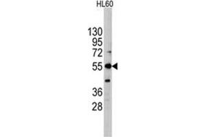 Image no. 1 for anti-Intestinal Alkaline Phosphatase (ALPI) (Center) antibody (ABIN356999) (Intestinal Alkaline Phosphatase Antikörper  (Center))