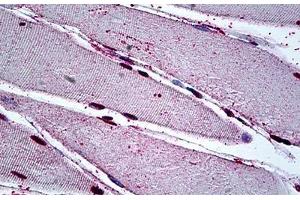 Human Skeletal Muscle: Formalin-Fixed, Paraffin-Embedded (FFPE) (MEOX2 Antikörper  (AA 1-304))