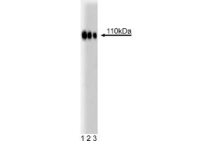 Western Blotting (WB) image for anti-Espin (ESPN) (AA 458-580) antibody (ABIN968627) (Espin Antikörper  (AA 458-580))