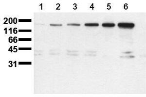 Western Blotting (WB) image for anti-Receptor tyrosine-protein kinase erbB-2 (ErbB2/Her2) (pSer1113) antibody (ABIN126790) (ErbB2/Her2 Antikörper  (pSer1113))