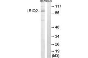 Western Blotting (WB) image for anti-Centrosomal Protein 97kDa (CEP97) (AA 581-630) antibody (ABIN2890391) (CEP97 Antikörper  (AA 581-630))