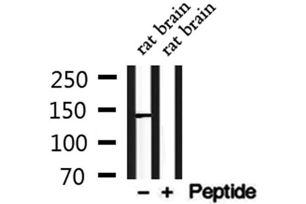 CADPS2 Antikörper  (N-Term)