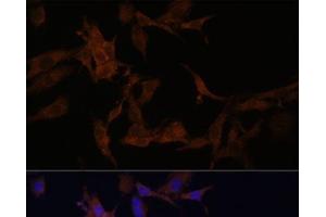 Immunofluorescence (IF) image for anti-serpin Peptidase Inhibitor, Clade B (Ovalbumin), Member 9 (SERPINB9) antibody (ABIN7262204)
