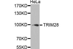 Western Blotting (WB) image for anti-Tripartite Motif Containing 28 (TRIM28) (AA 576-835) antibody (ABIN1683037) (KAP1 Antikörper  (AA 576-835))