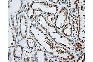Immunohistochemical staining of paraffin-embedded Kidney tissue using anti-ARNT mouse monoclonal antibody. (ARNT Antikörper)