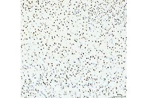 IHC analysis of HDAC2 using anti-HDAC2 antibody (ABIN7601564). (HDAC2 Antikörper  (AA 387-488))