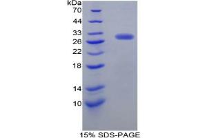 SDS-PAGE analysis of Rat Dopamine Receptor D2 Protein. (Dopamine d2 Receptor Protein)
