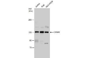 WB Image CYFIP2 antibody detects CYFIP2 protein by western blot analysis. (CYFIP2 Antikörper)