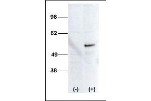 Western blot analysis of anti-STK38L Pab transiently transfected HEK-293 cell line lysate (1ug/lane).