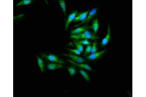 Immunofluorescence staining of Hela cells with ABIN7160013 at 1:266, counter-stained with DAPI. (JNK2 Antikörper  (AA 1-424))