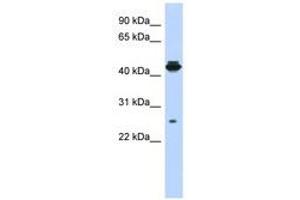 Image no. 1 for anti-PDLIM1 Interacting Kinase 1 Like (PDIK1L) (AA 107-156) antibody (ABIN6741226) (PDIK1L Antikörper  (AA 107-156))