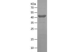 Western Blotting (WB) image for Intercellular Adhesion Molecule 1 (ICAM1) (AA 26-272) protein (His-IF2DI Tag) (ABIN7123480) (ICAM1 Protein (AA 26-272) (His-IF2DI Tag))