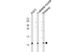 All lanes : Anti-NDUFA1 Antibody (Center) at 1:2000 dilution Lane 1: A-673 whole cell lysate Lane 2: human skeletal muscle lysate Lane 3: mouse kidney lysate Lysates/proteins at 20 μg per lane. (NDUFA1 Antikörper  (AA 26-59))