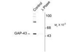 Image no. 1 for anti-Growth Associated Protein 43 (GAP43) (pSer41) antibody (ABIN227321) (GAP43 Antikörper  (pSer41))