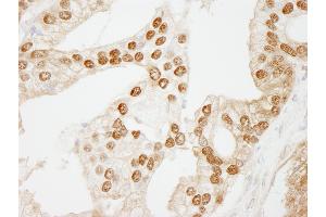 Immunohistochemistry (IHC) image for anti-WD Repeat Domain 77 (WDR77) (AA 292-342) antibody (ABIN7449034) (WDR77 Antikörper  (AA 292-342))
