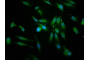 Immunofluorescence staining of Hela cells with ABIN7158776 at 1:166, counter-stained with DAPI. (PRCP Antikörper  (AA 347-443))