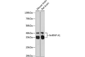 Western blot analysis of extracts of various cell lines, using hnRNP  Rabbit mAb (1564) at 1:1000 dilution. (HNRNPA1 Antikörper)