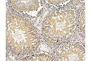 ABIN7096225 and ABIN7100287 at 1/100 staining rat testis tissue by IHC-P. (DSCR3 Antikörper)