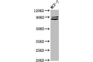 Western Blot Positive WB detected in: MCF-7 whole cell lysate All lanes: MED15 antibody at 5. (MED15 Antikörper  (AA 433-530))
