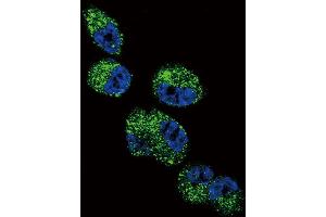 Immunofluorescence (IF) image for anti-Cytochrome P450, Family 4, Subfamily A, Polypeptide 11 (CYP4A11) antibody (ABIN3003554) (CYP4A11 Antikörper)