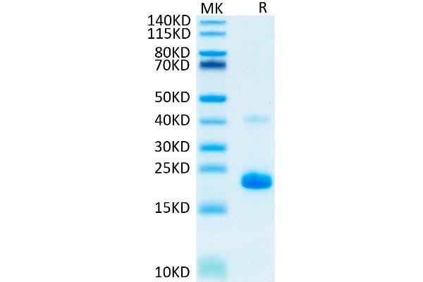 TNF alpha Protein (AA 77-233) (His-Avi Tag)