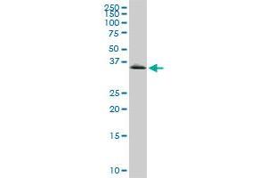 GYG1 monoclonal antibody (M07), clone 3B5. (Glycogenin 1 Antikörper  (AA 1-73))