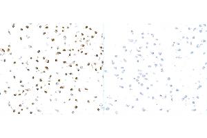 Immunocytochemistry (ICC) image for anti-gamma Histone Variant H2AX (GAMMA-H2AX) (Ser140) antibody (ABIN7449557) (gamma H2AX Antikörper  (Ser140))