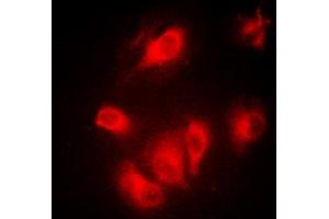 Immunofluorescent analysis of Aurora A staining in MCF7 cells. (Aurora A Antikörper  (C-Term))