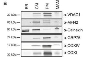anti-Heat Shock 70kDa Protein 9 (Mortalin) (HSPA9) (AA 551-766) antibody
