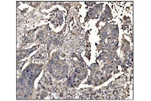 IHC analysis of DHPS/DHS using anti-DHPS/DHS antibody (ABIN7601998). (DHPS Antikörper  (AA 54-358))