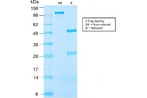SDS-PAGE (SDS) image for anti-Insulin-Like Growth Factor 1 (IGF1) antibody (ABIN6939702)