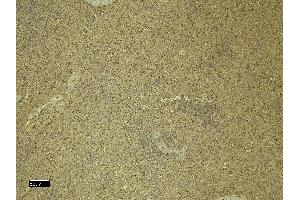 Immunohistochemistry (IHC) image for anti-Chemokine (C-X-C Motif) Receptor 3 (CXCR3) (C-Term) antibody (ABIN334381)