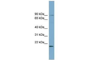 WB Suggested Anti-KIAA0776 Antibody Titration: 0.