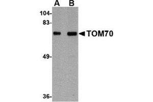 Western blot analysis of TOM70 in rat brain tissue lysate with this product at (A) 1 and (B) 2 μg/ml. (TOM70 Antikörper  (Center))